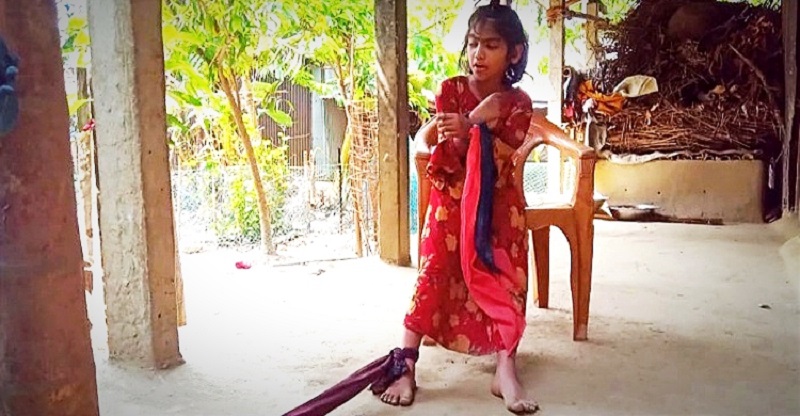 রশিতে বাঁধা ৮ বছরের শিশু তায়িবার জীবন,অর্থাভাবে হচ্ছে না চিকিৎসা