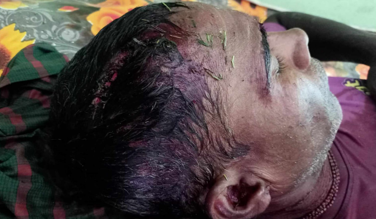 ইছামতিতে বিএসএফের আঘাতে জেলে আহত