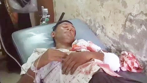 লোহাগড়ায় সন্ত্রাসী হামলায় বিএনপি নেতা আহত