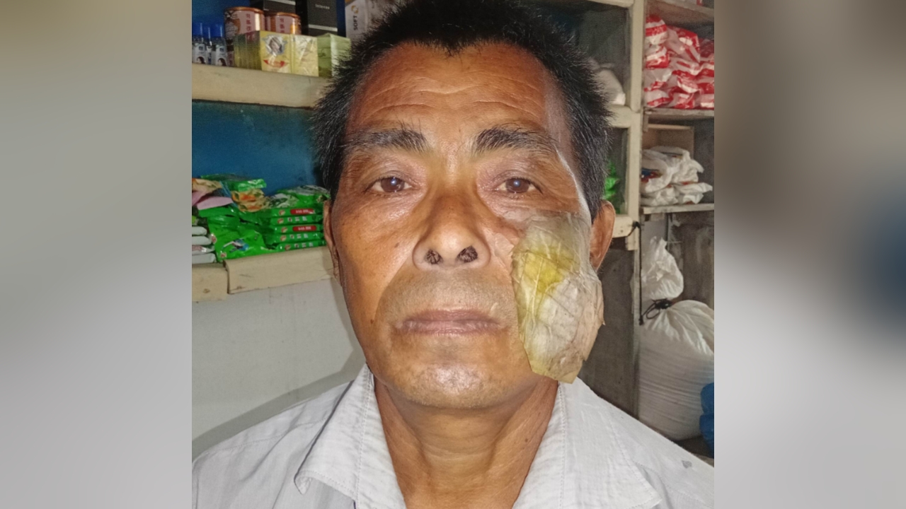 বাঁচতে চান ক্যান্সারে আক্রান্ত ক্যসুইউ মারমা